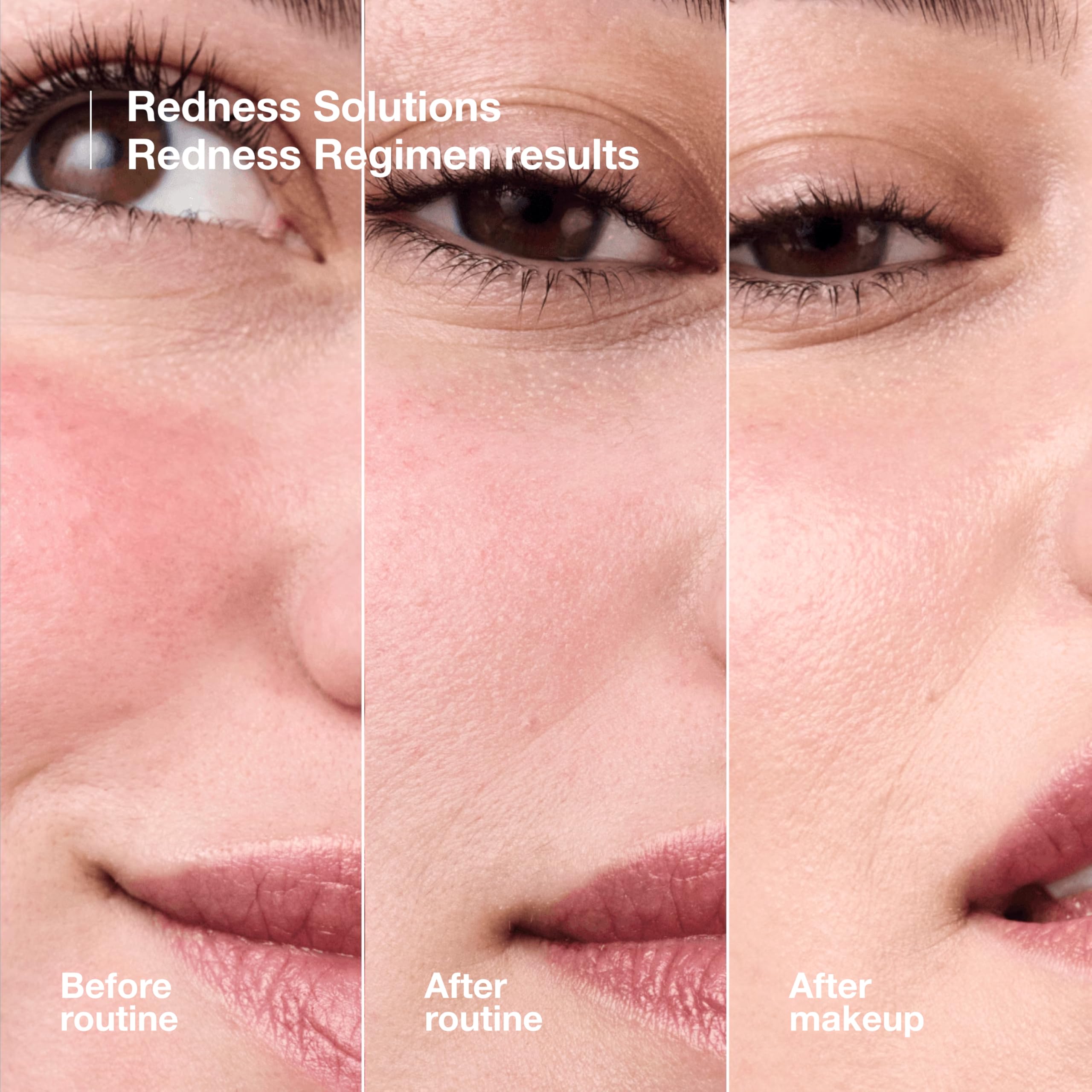 Clinique Redness Solutions Liquid Foundation SPF 15 with Probiotic Technology for Redness 4