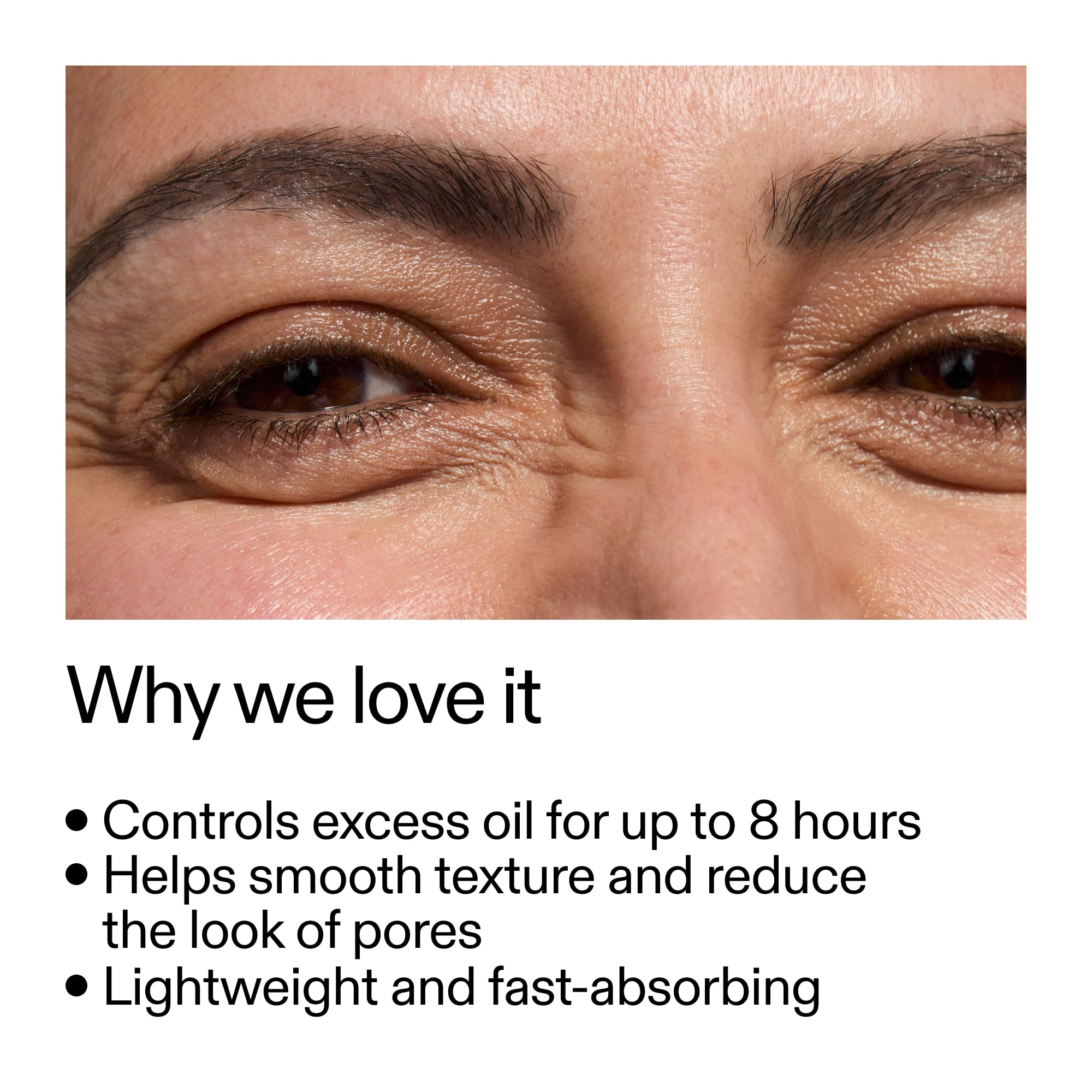 The Inkey List Niacinamid 20% Serum 30ml, Supersolutions, bekämpft Rötungen