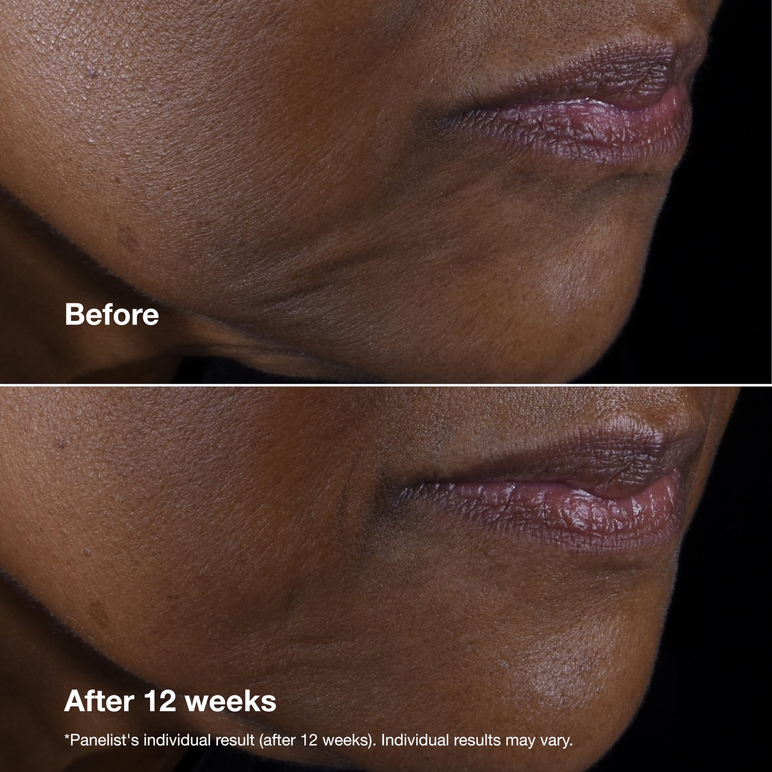Clinique Smart Clinical Repair Lifting Face + Neck Cream with 9% Peptides 5
