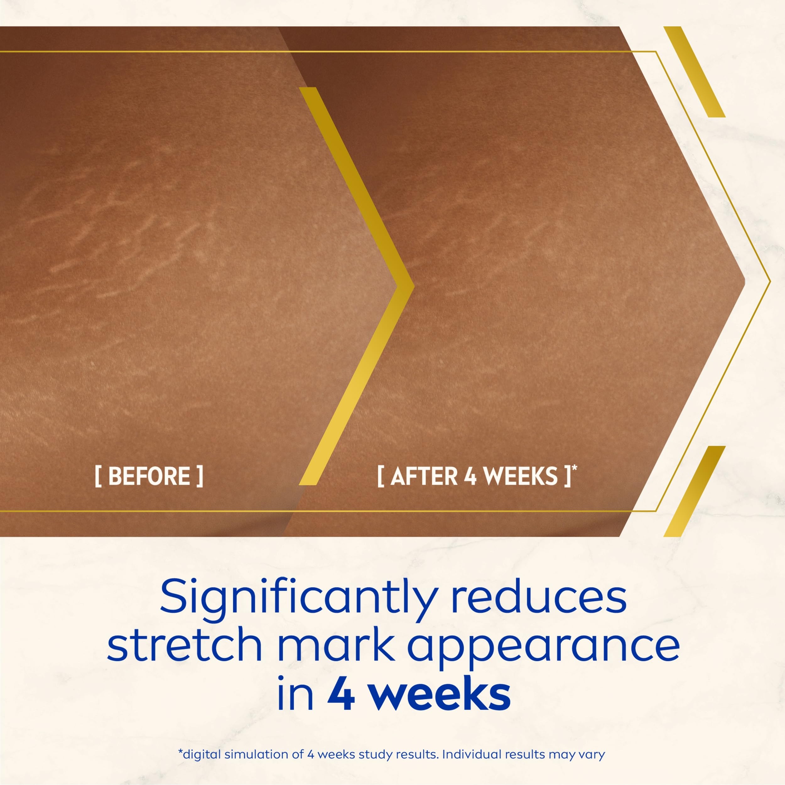 NIVEA Luminous 630 Body Oil Serum Anti Stretch Marks for Even Skin Tone (100ml) 4