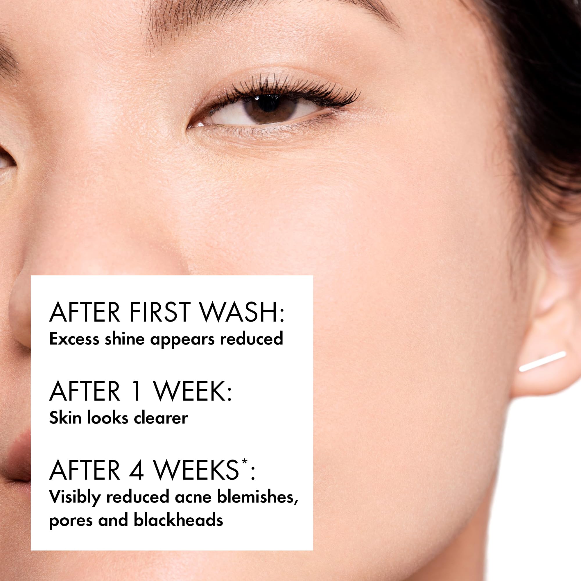 Vichy Normaderm Intensive Purifying Cleanser for Blemish-Prone Skin 6