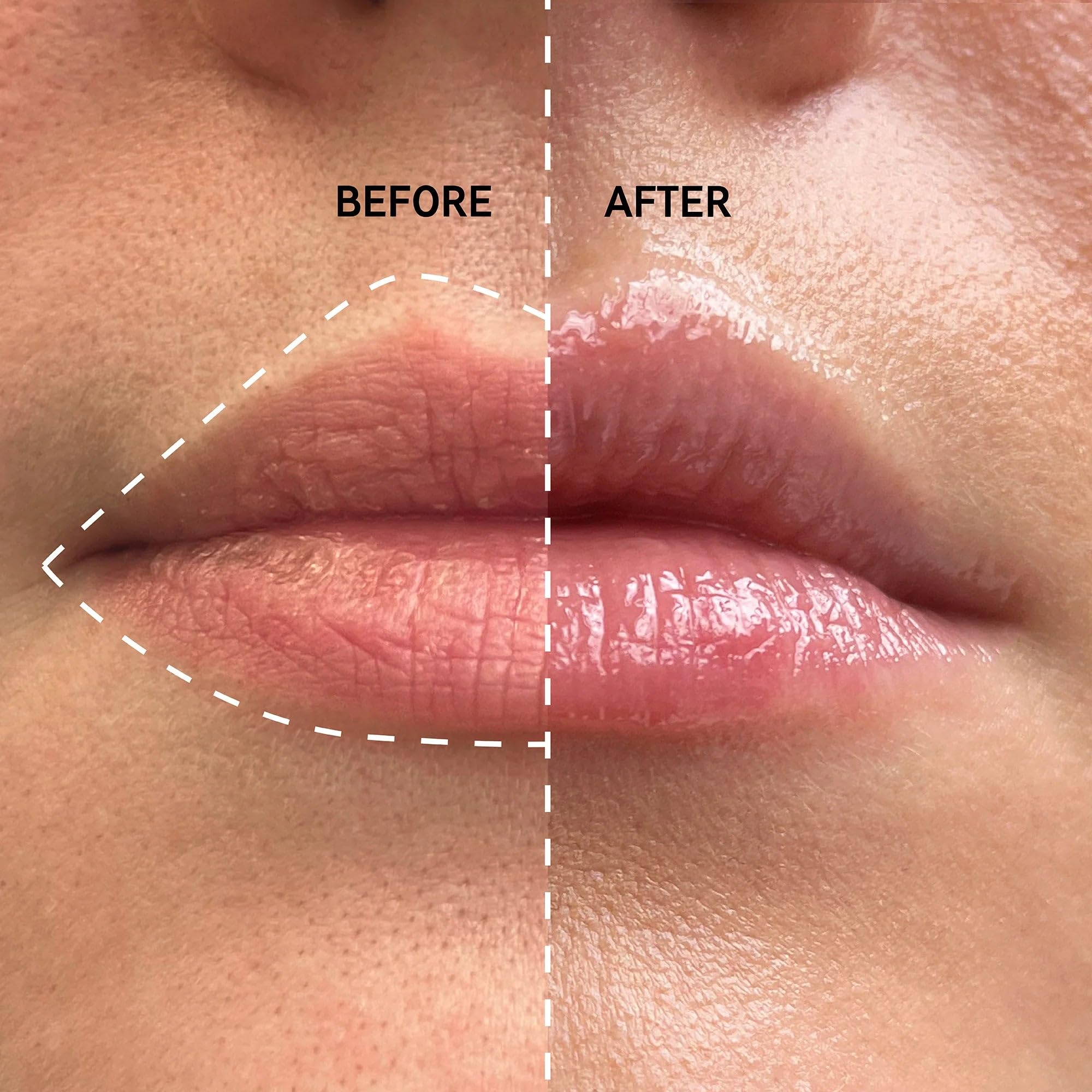 The INKEY List Plump It Up 20ml, Tripeptid-Lippenbalsam-Duo-Set, klinisch getestet 3