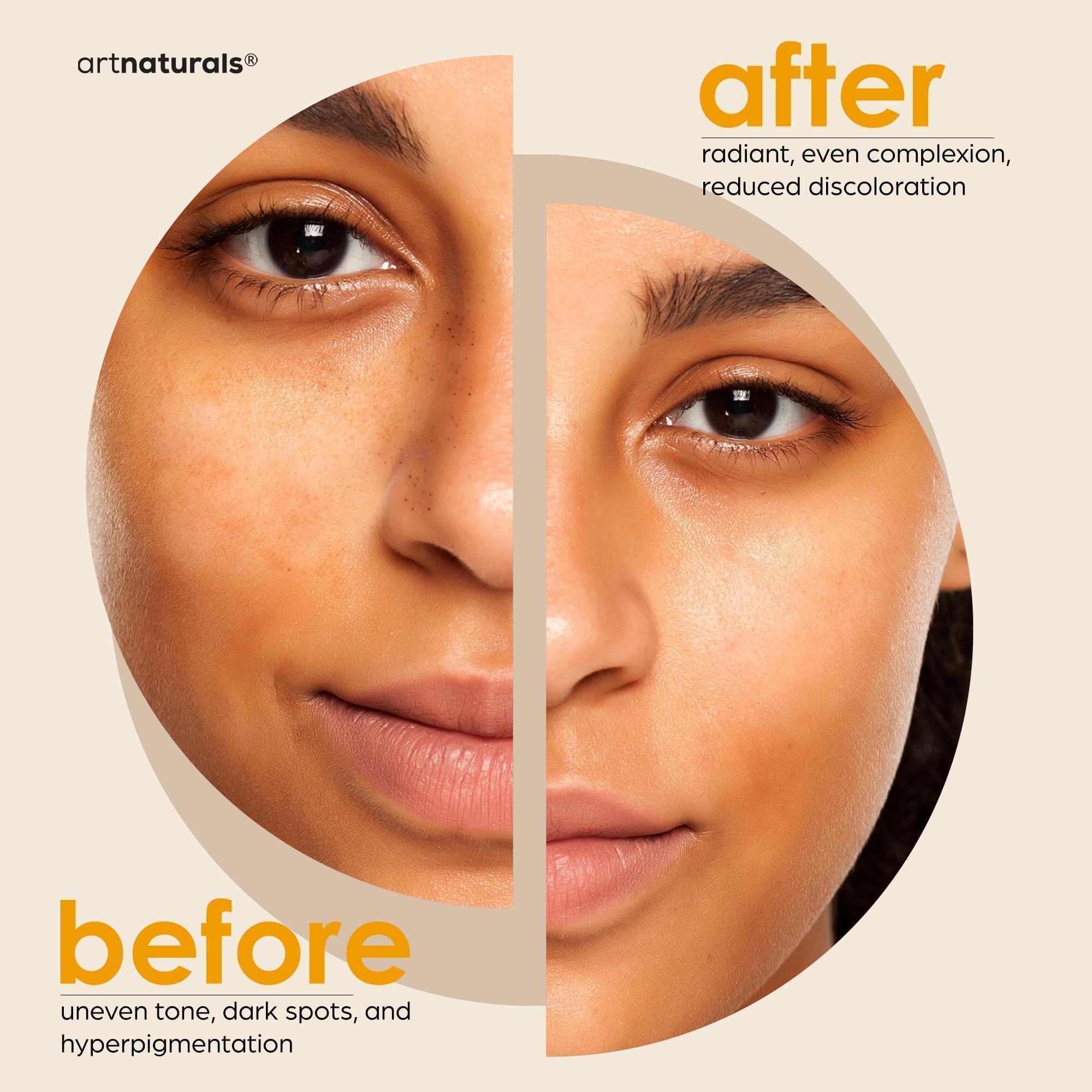 Kojisäureseife + Afrikanischer Netzschwamm (2er-Pack x 142 g Kurkuma-Seifenstücke) Dunkle Seife 4