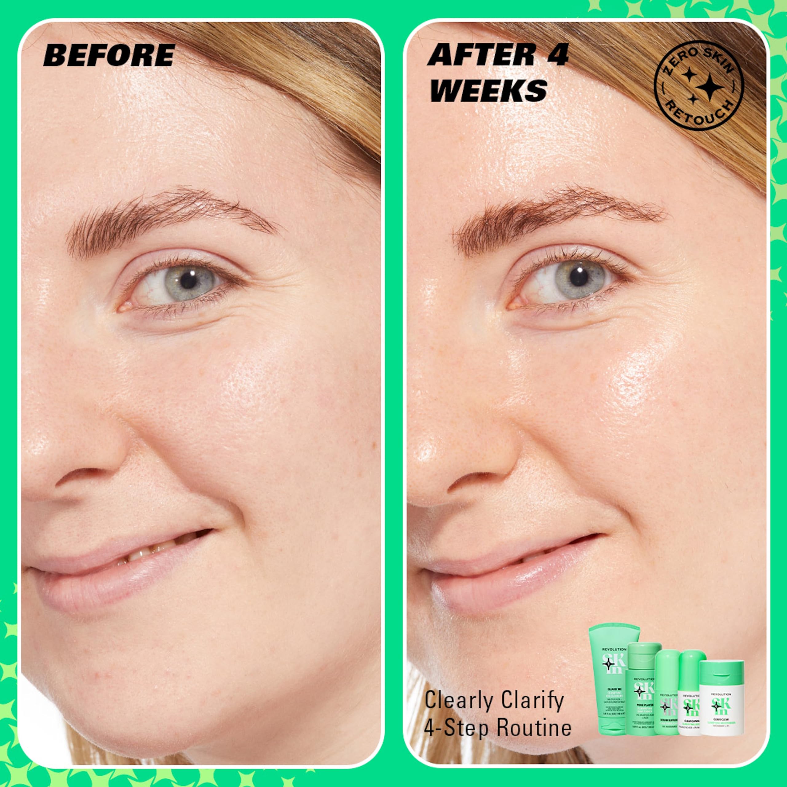 Revolution Skin, Clearly Clarify 4-Schritte-Starterset, Hautpflegeset für Unreinheiten 3