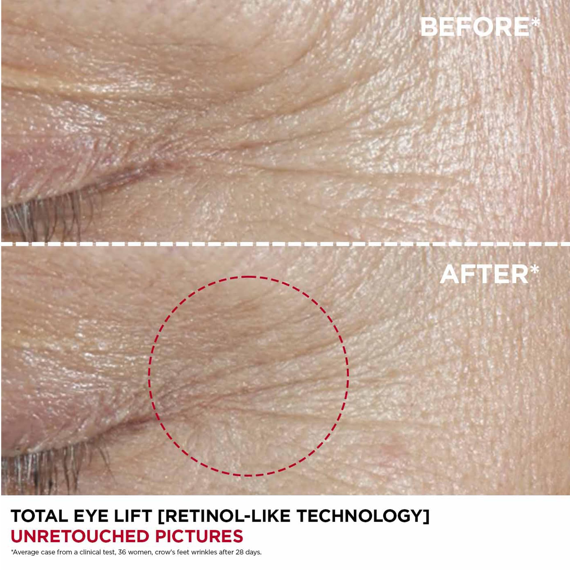 Clarins Total Eye Lift 15 ml 5