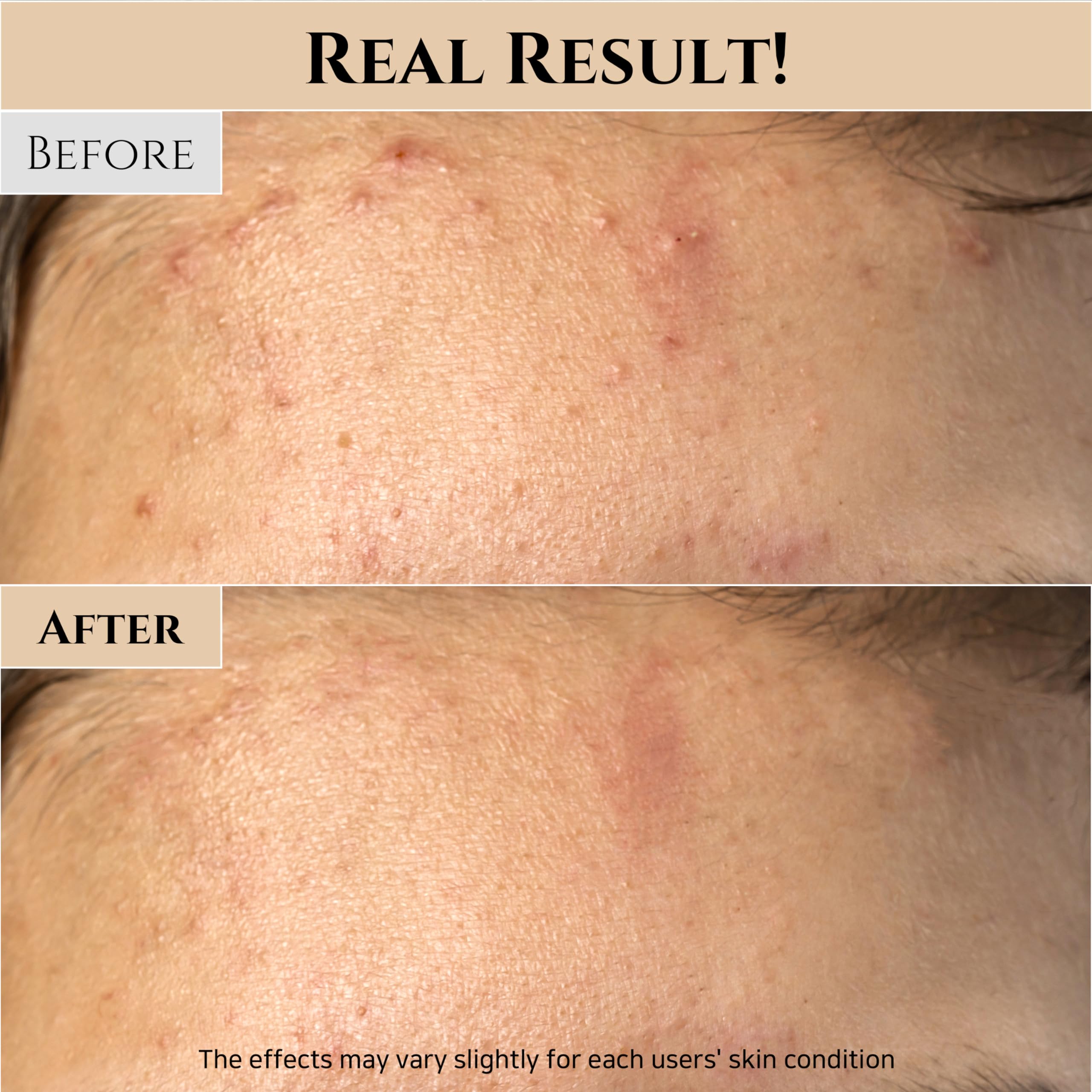 Beauty of Joseon Ground Rice and Honey Glow Wash-Off Face Pack for Hydration and Exfoliation 5