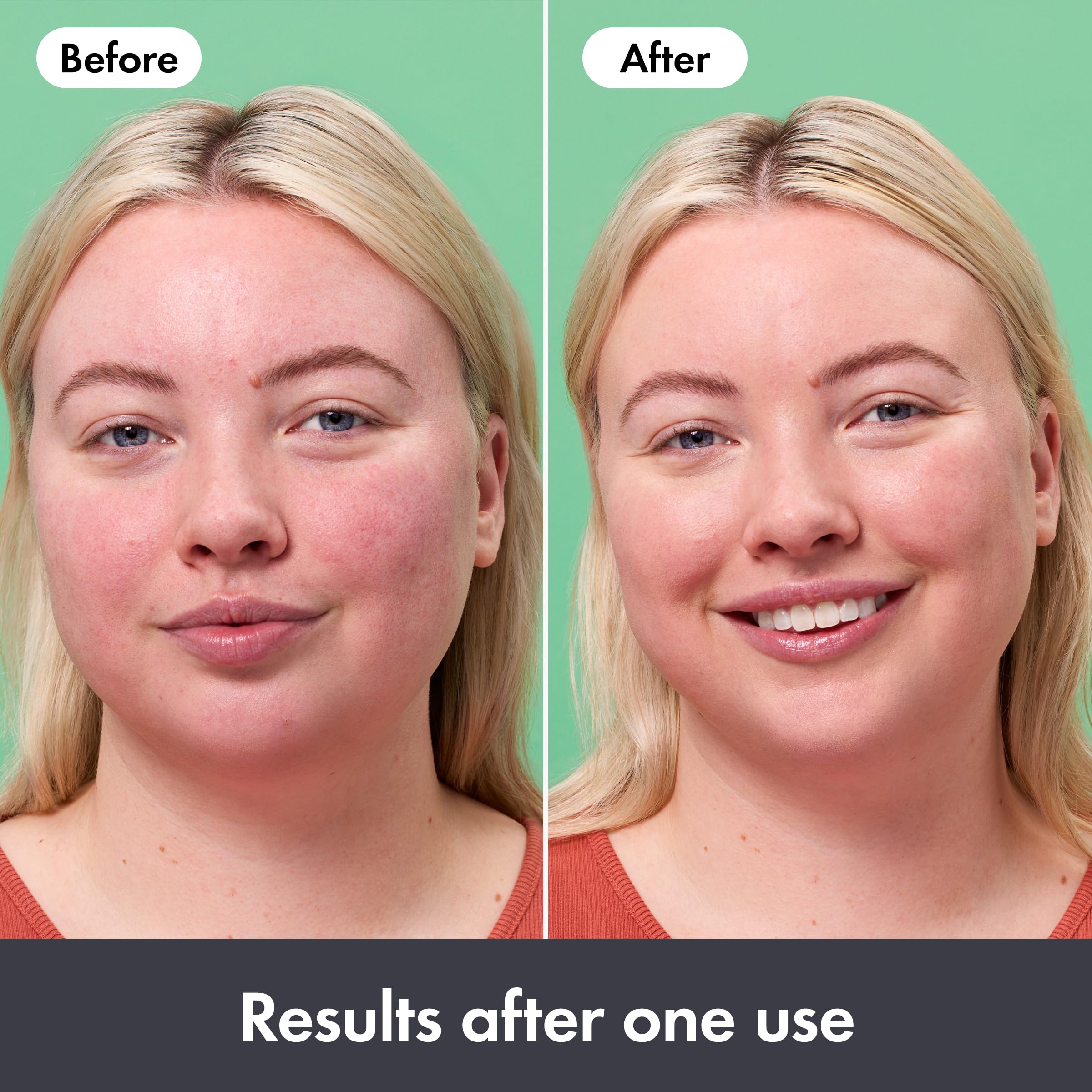 Hero Cosmetics Rescue Balm Post-Blemish Recovery Cream & Red Colour Corrector 3