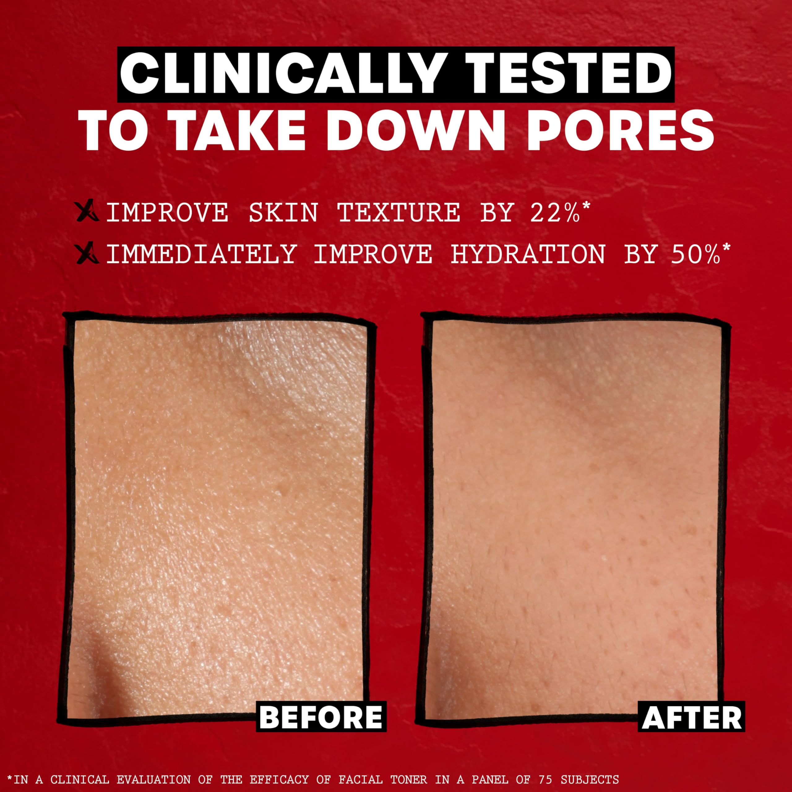 Thayers Witch Hazel Gentle Facial Mist Rose Petal Toner Lotion with Organic Aloe Vera 4