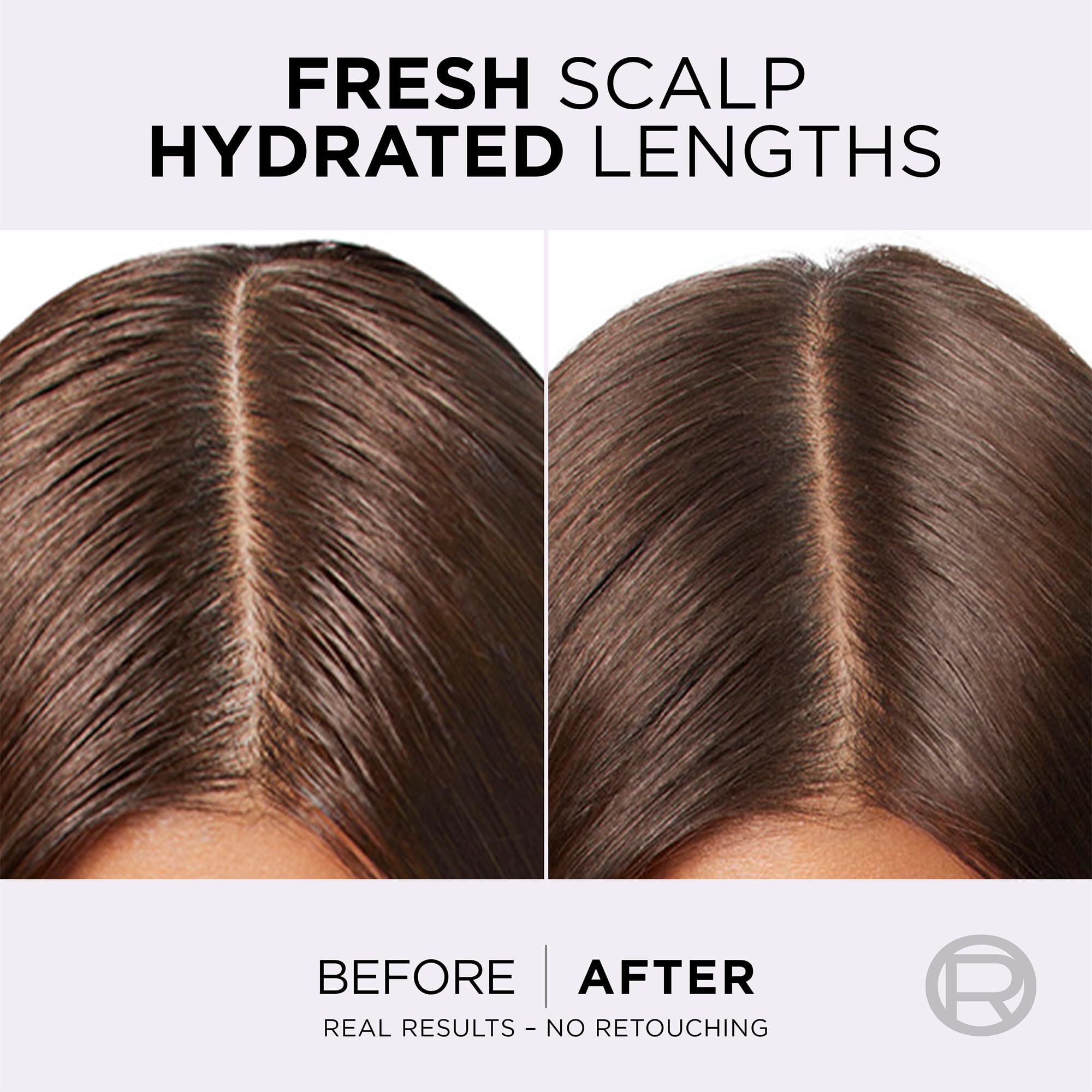 L’Oréal Paris Elvive Hydra Pure Exfoliating Pre-Shampoo Scalp Serum for Oily Roots, 102ml 4