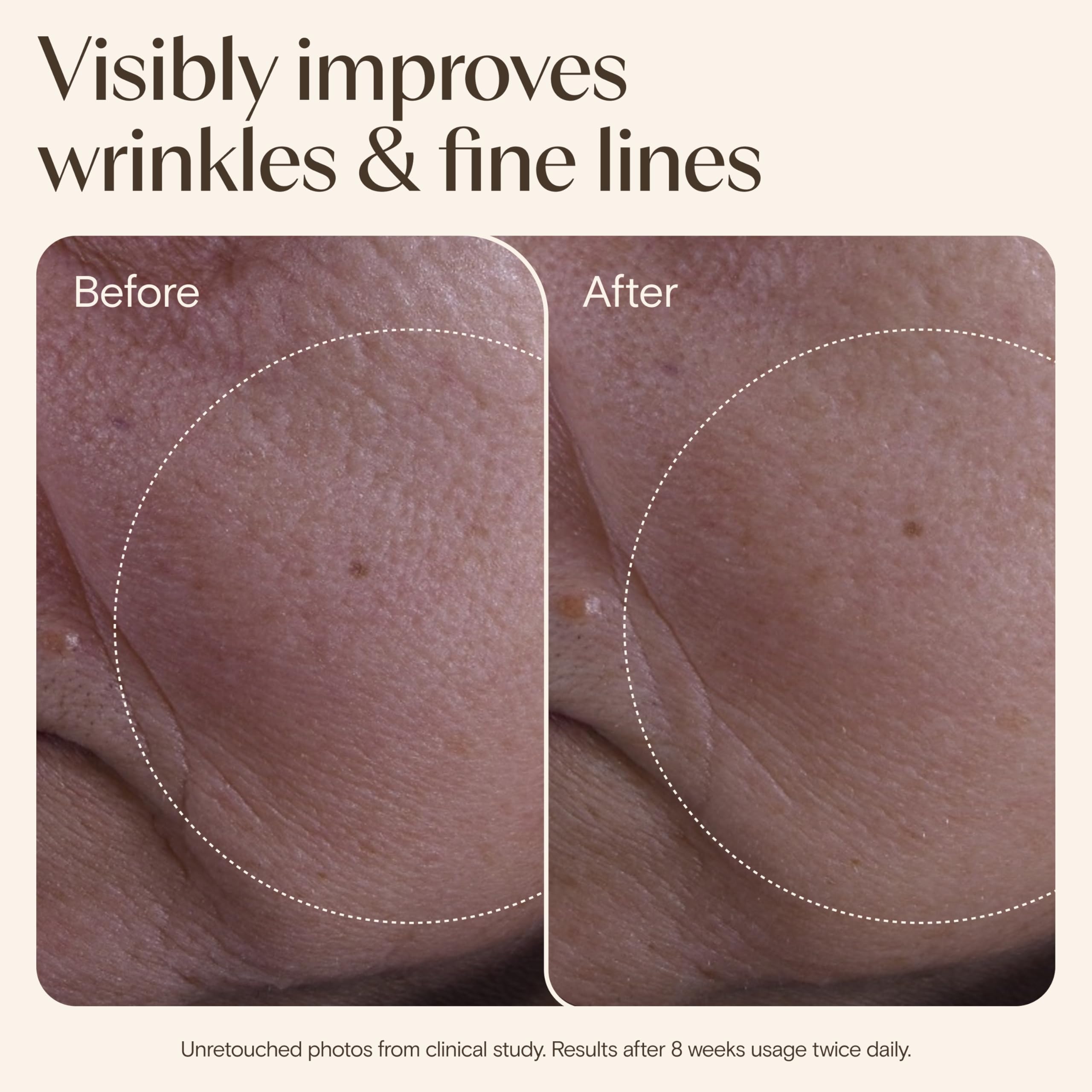 AVEENO Age Renewal Serum with Oat + Retinol Alternative for Wrinkles and Firmness 30ml 7