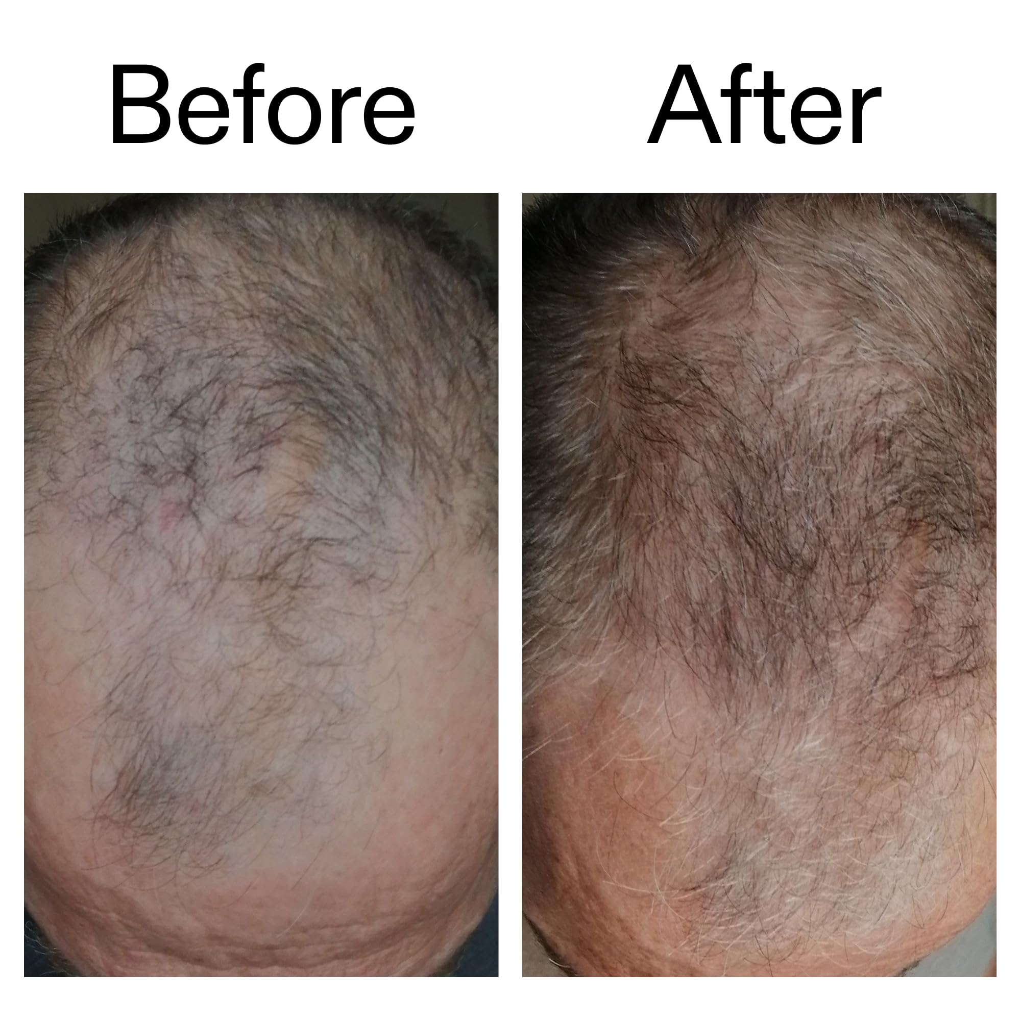 The INKEY List 1% Caffeine Stimulating Scalp Serum for Hair Loss Reduction 5