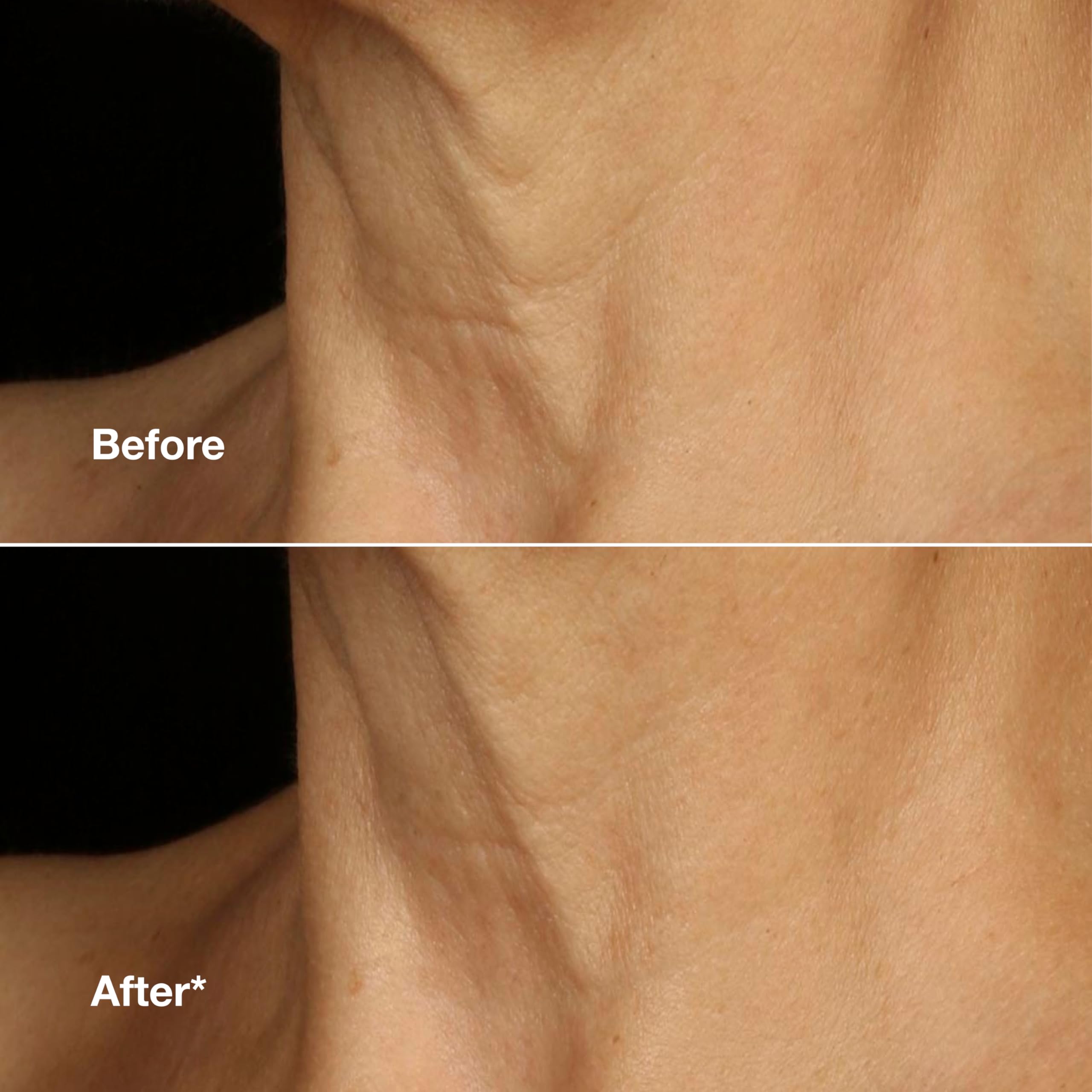 Clinique Smart Clinical Repair Lifting Face + Neck Cream with 9% Peptides 4