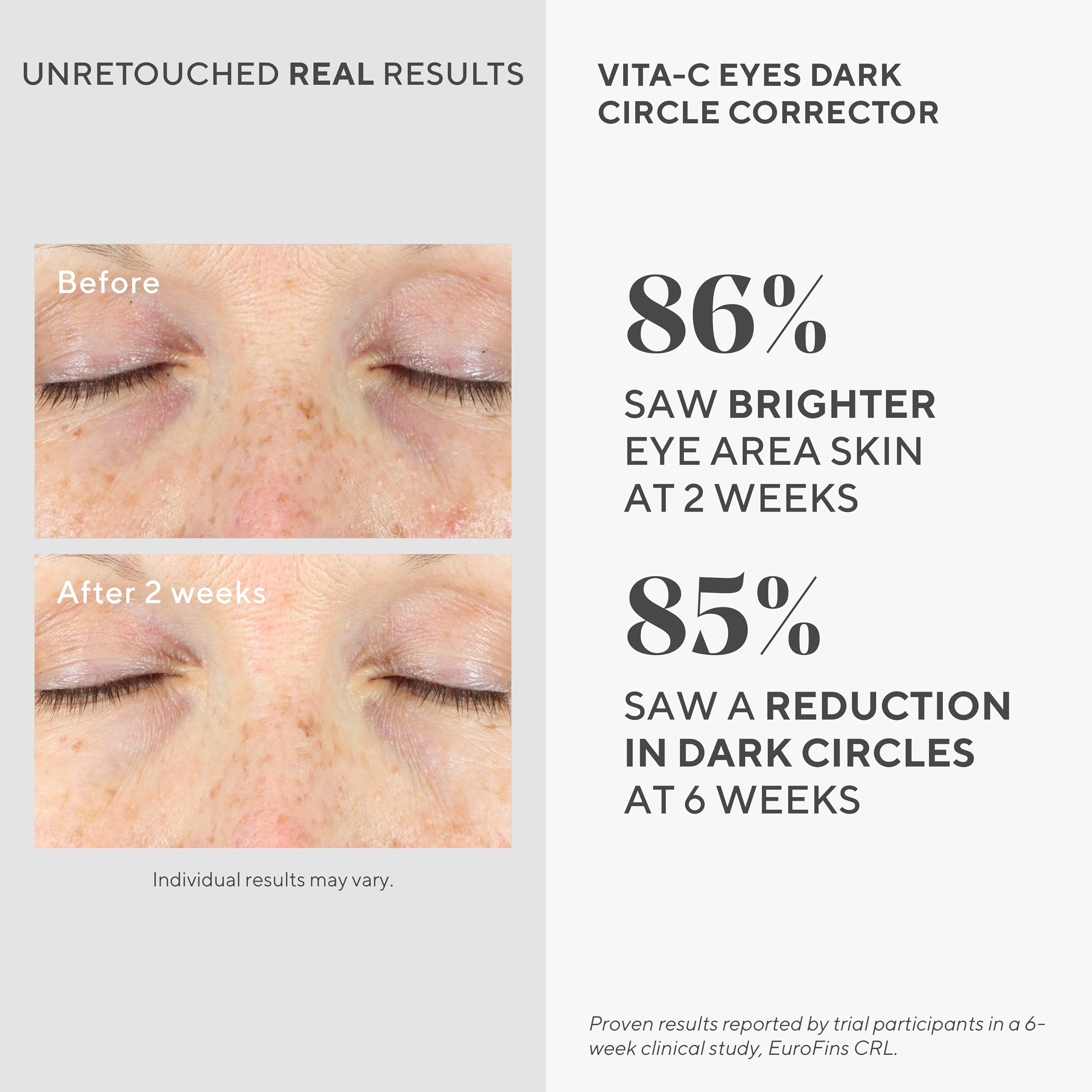 Murad Environmental Shield VITA-C Eyes Dark Circle Corrector Vitamin C Eye Treatment 3