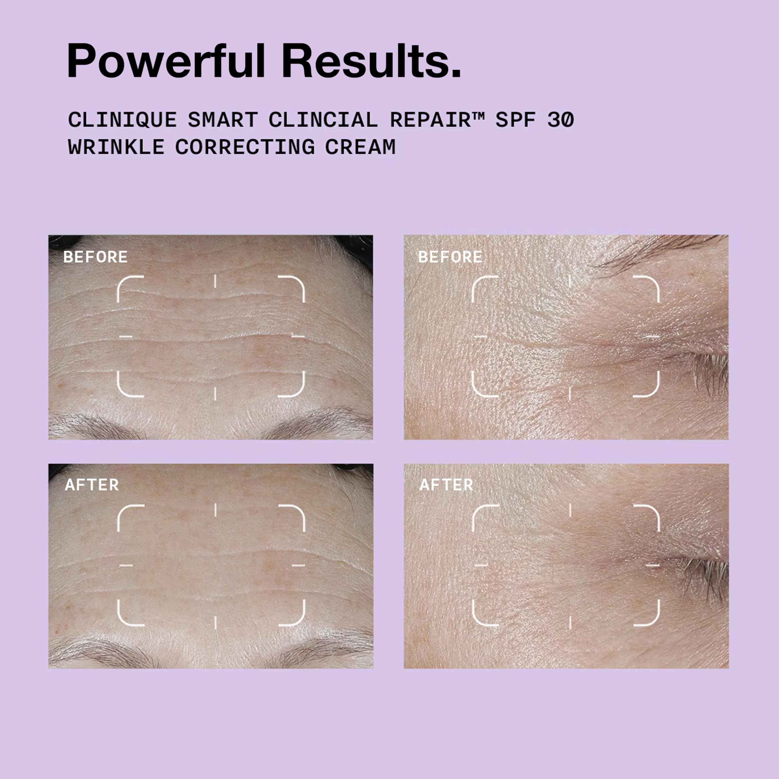 Clinique Smart Clinical Repair SPF 30 Wrinkle Correcting Cream With Peptide 4