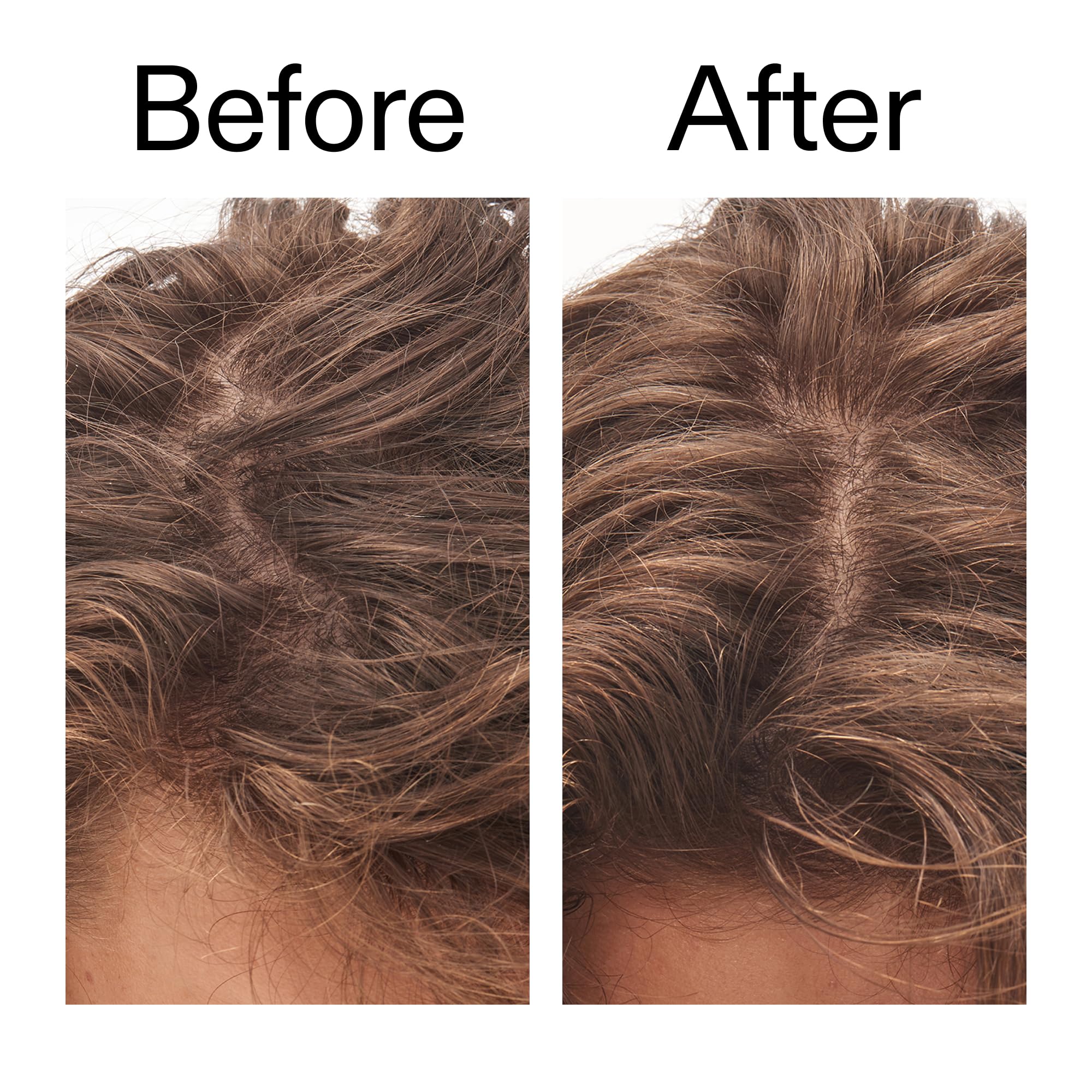 The Inkey List 7% Glycolic Acid Exfoliating Scalp Scrub for Product Build Up 150ml 6