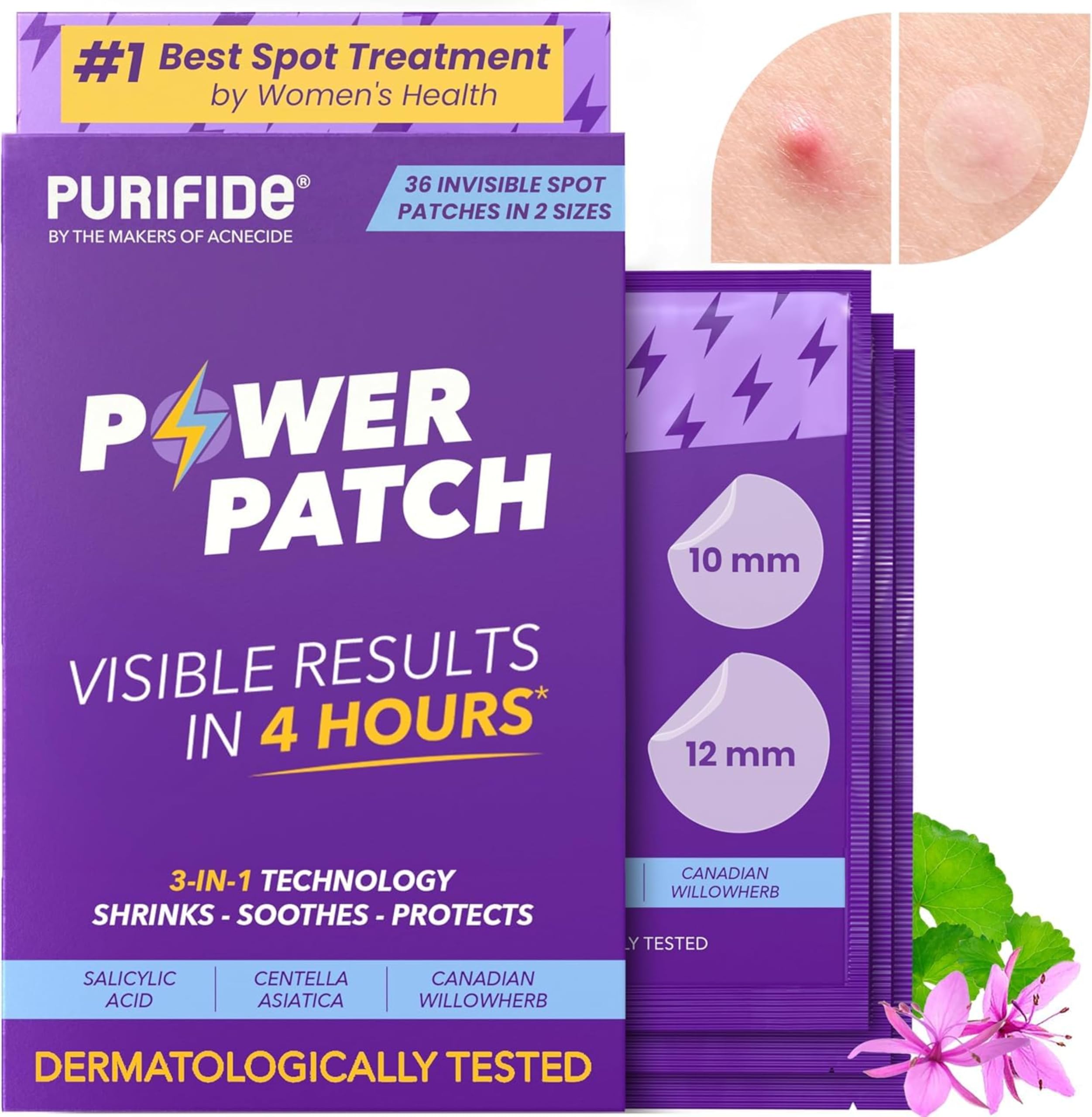 Acnecide Purifide Power Pimple Patches - 36 Invisible Spot Treatments with Salicylic Acid
