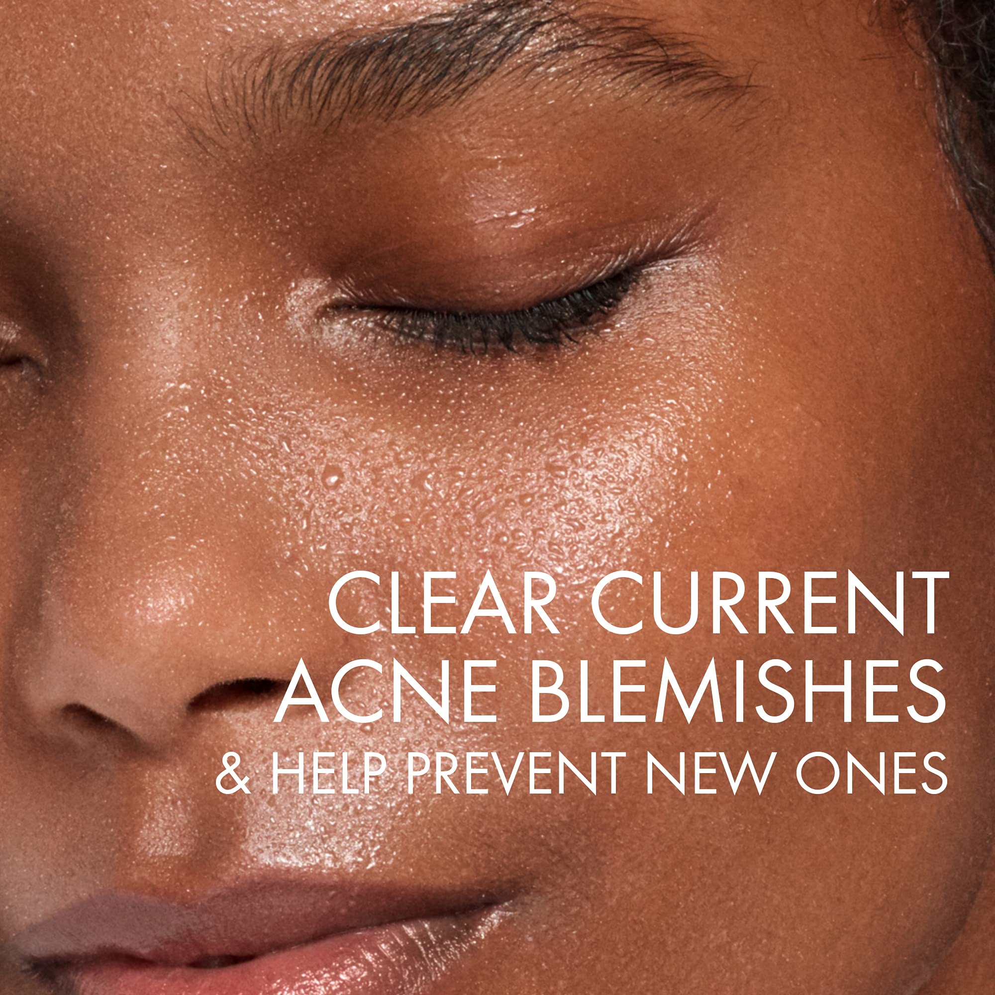 Vichy Normaderm Intensive Purifying Cleanser for Blemish-Prone Skin 3