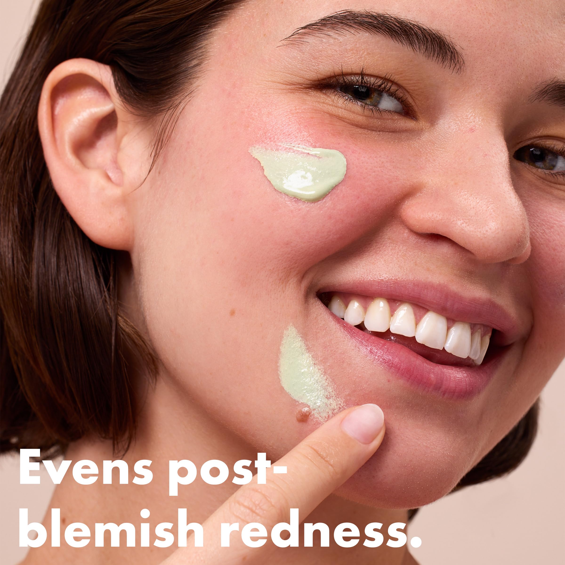 Hero Cosmetics Rescue Balm Post-Blemish Recovery Cream & Red Colour Corrector