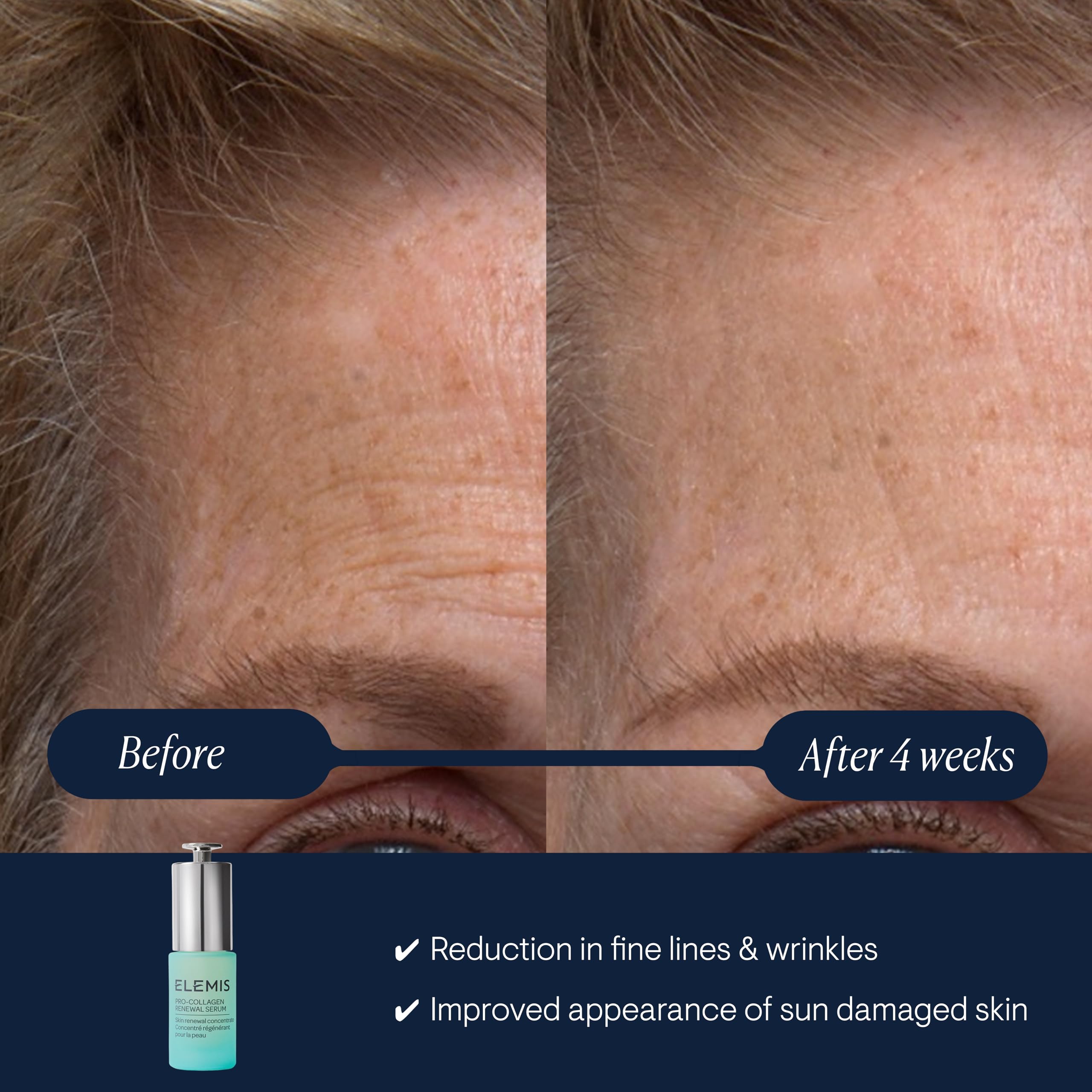 Elemis Pro-Collagen Renewal Serum 15ml: Anti-Aging, Hydrating Serum for Fine Lines and Firmness