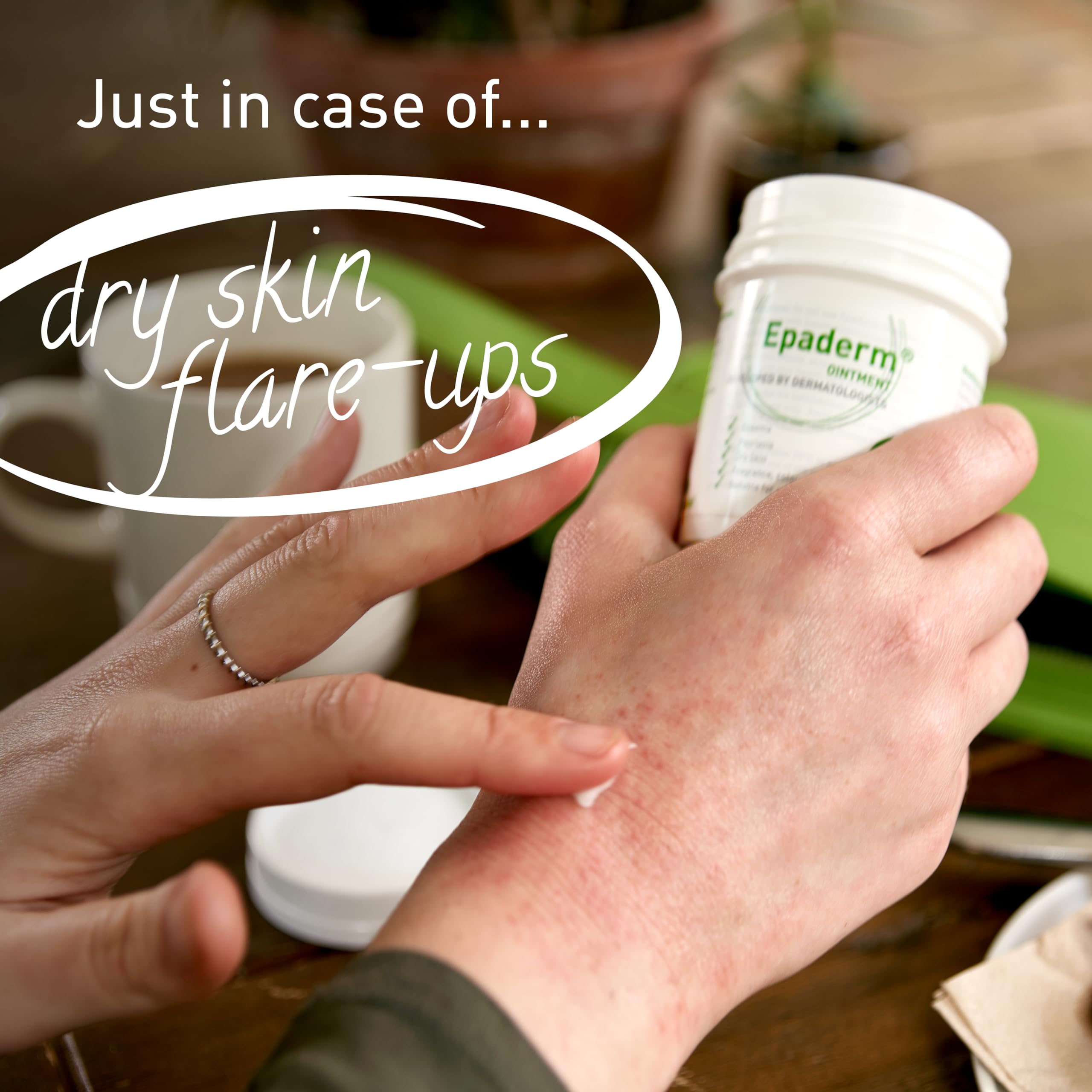 Epaderm Emollient Ointment 125g for Eczema, Psoriasis, and Dry Skin Management 8