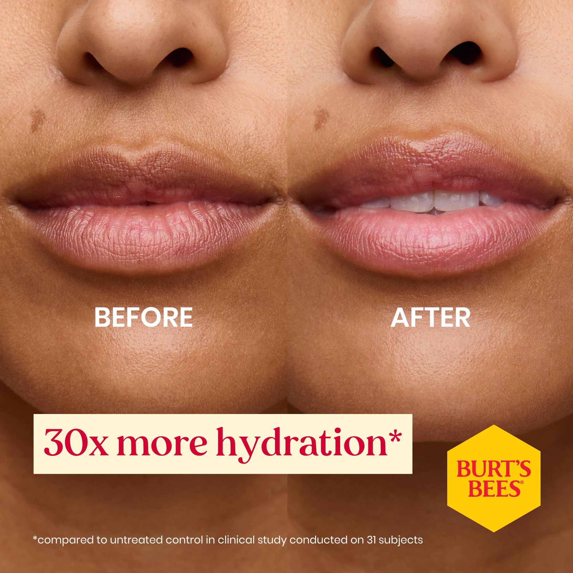 Burt's Bees Lippenbalsam Geburtstagskuchen, Feuchtigkeitsspendender Lippenbalsam mit Bienenwachs und 6