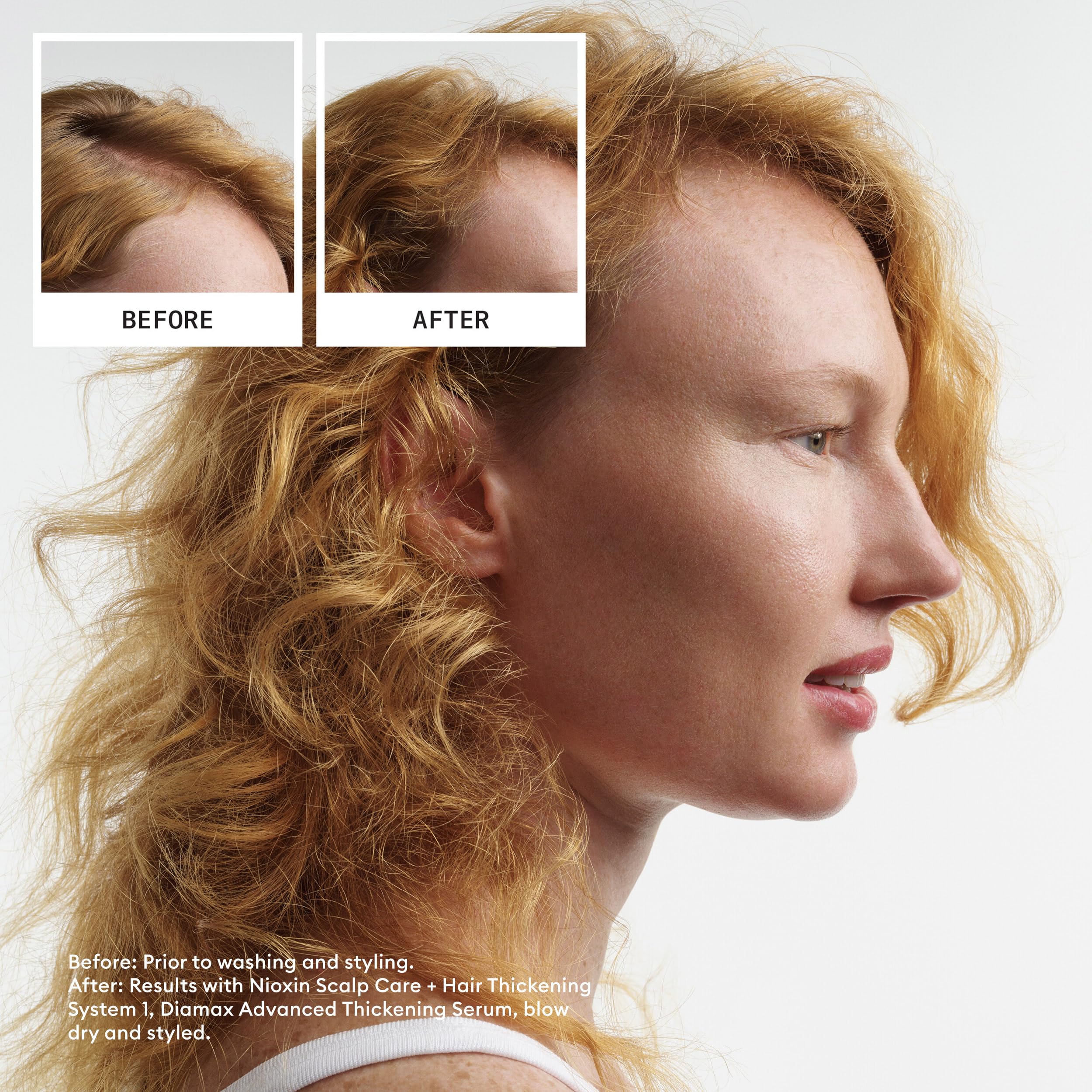 NIOXIN Scalp + Hair Thickening System 1 Loyalty Kit for Natural Hair with Light Thinning 6