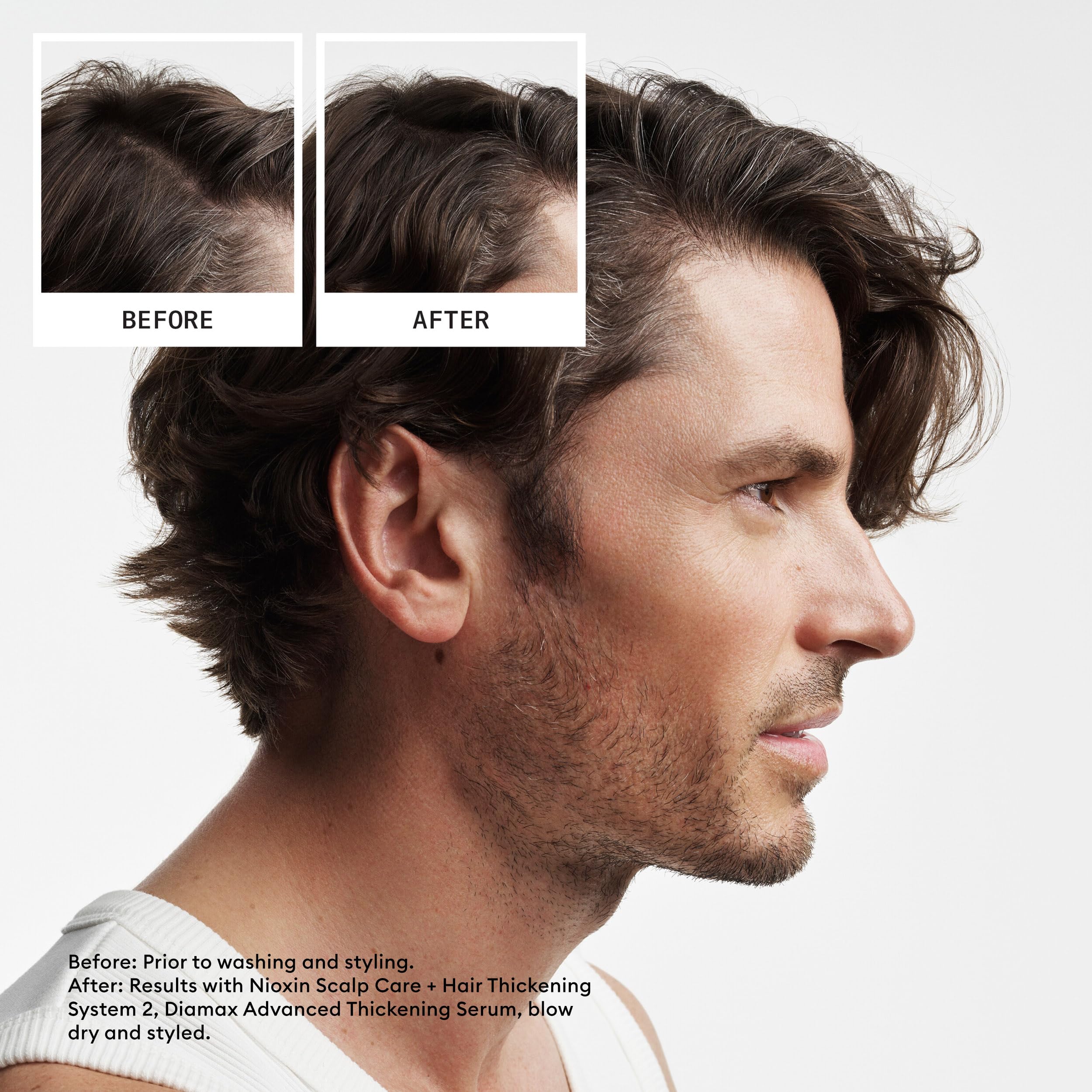 Nioxin Scalp + Hair Thickening System 2 Kit - Haarverdichtungssystem für natürliches Haar mit fortschreitender Ausdünnung - Shampoo, Spülung &amp; Kopfhautbehandlung (150+150+40ml) 5