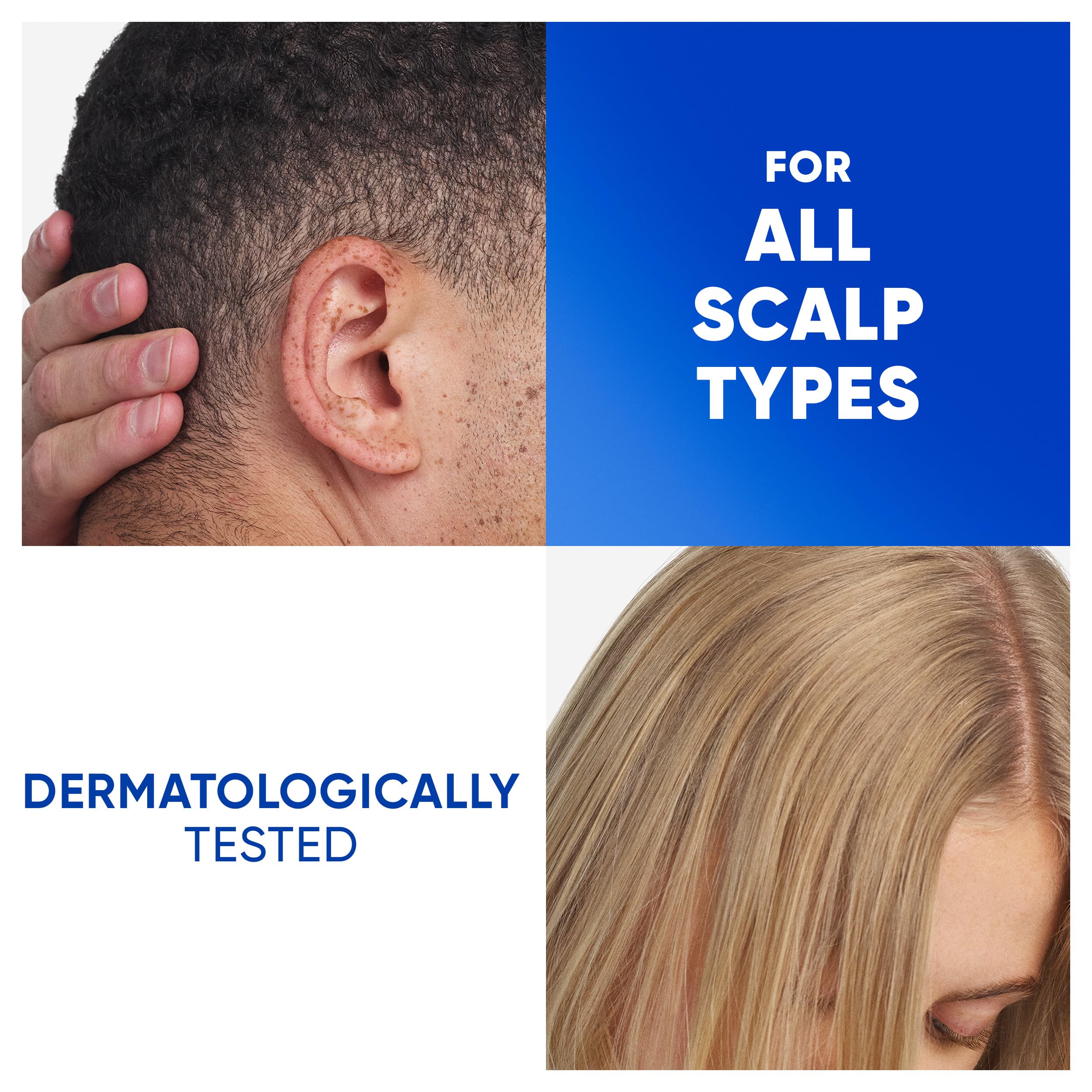 Head & Shoulders Classic Clean Anti-Dandruff Shampoo for Men & Women (400ml) 7