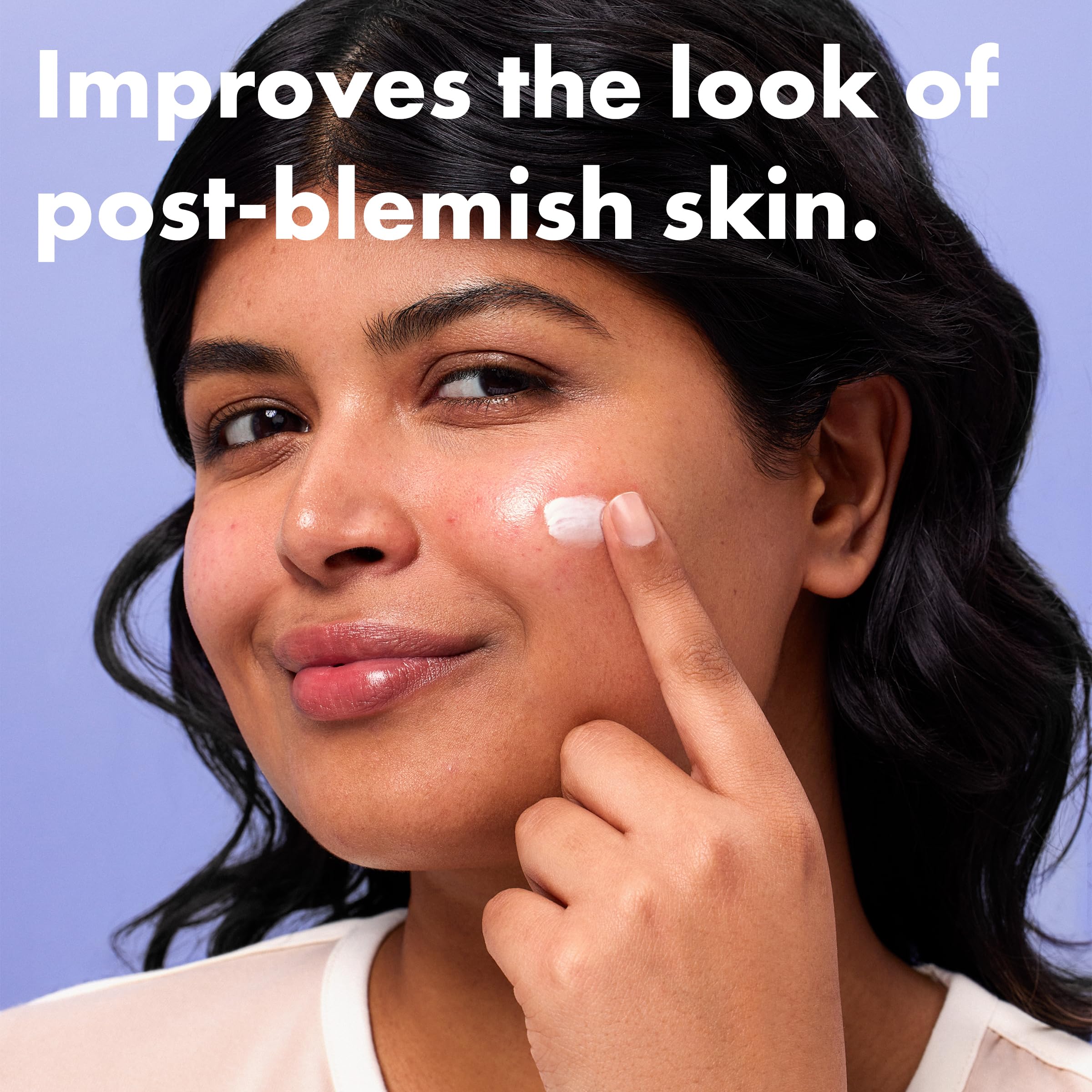 Hero Cosmetics Rescue Balm Post-Blemish Recovery Cream for Nourishing Hydration