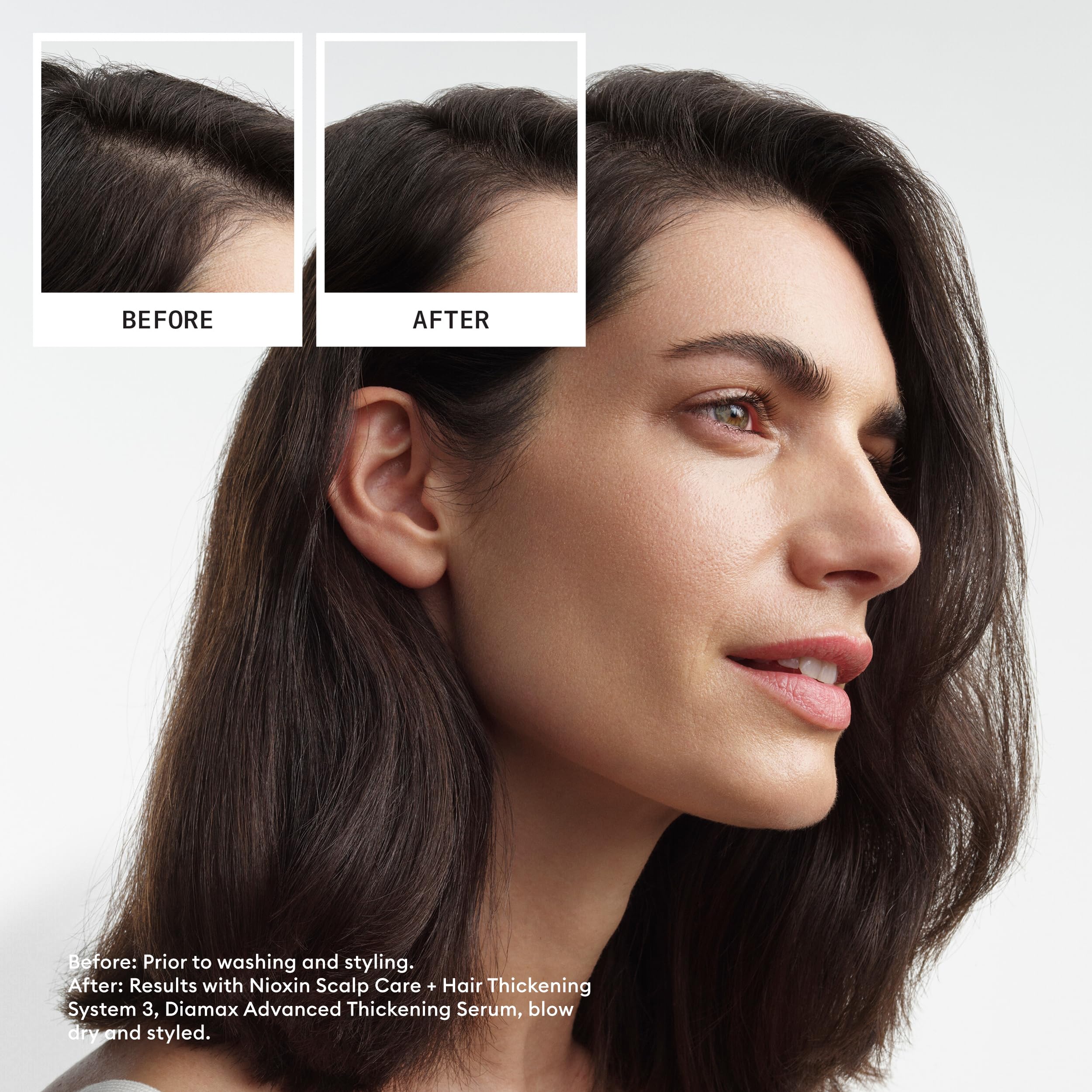 NIOXIN Scalp + Hair Thickening System 3 Loyalty Kit for Coloured, Dry, Damaged Hair 5