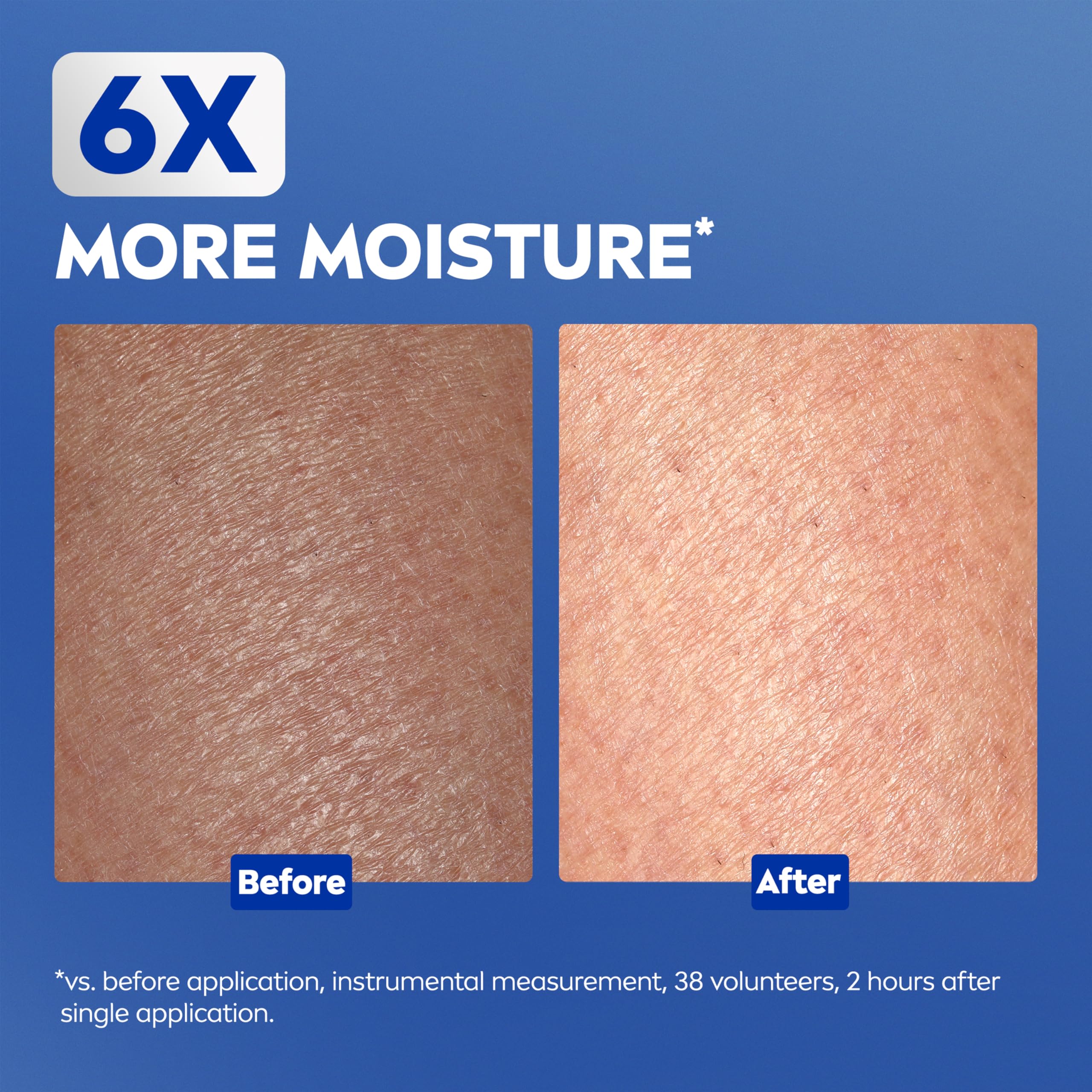 NIVEA Repair & Care Urea Cream for Extremely Dry Skin, 400ml, Deeply Hydrating 9