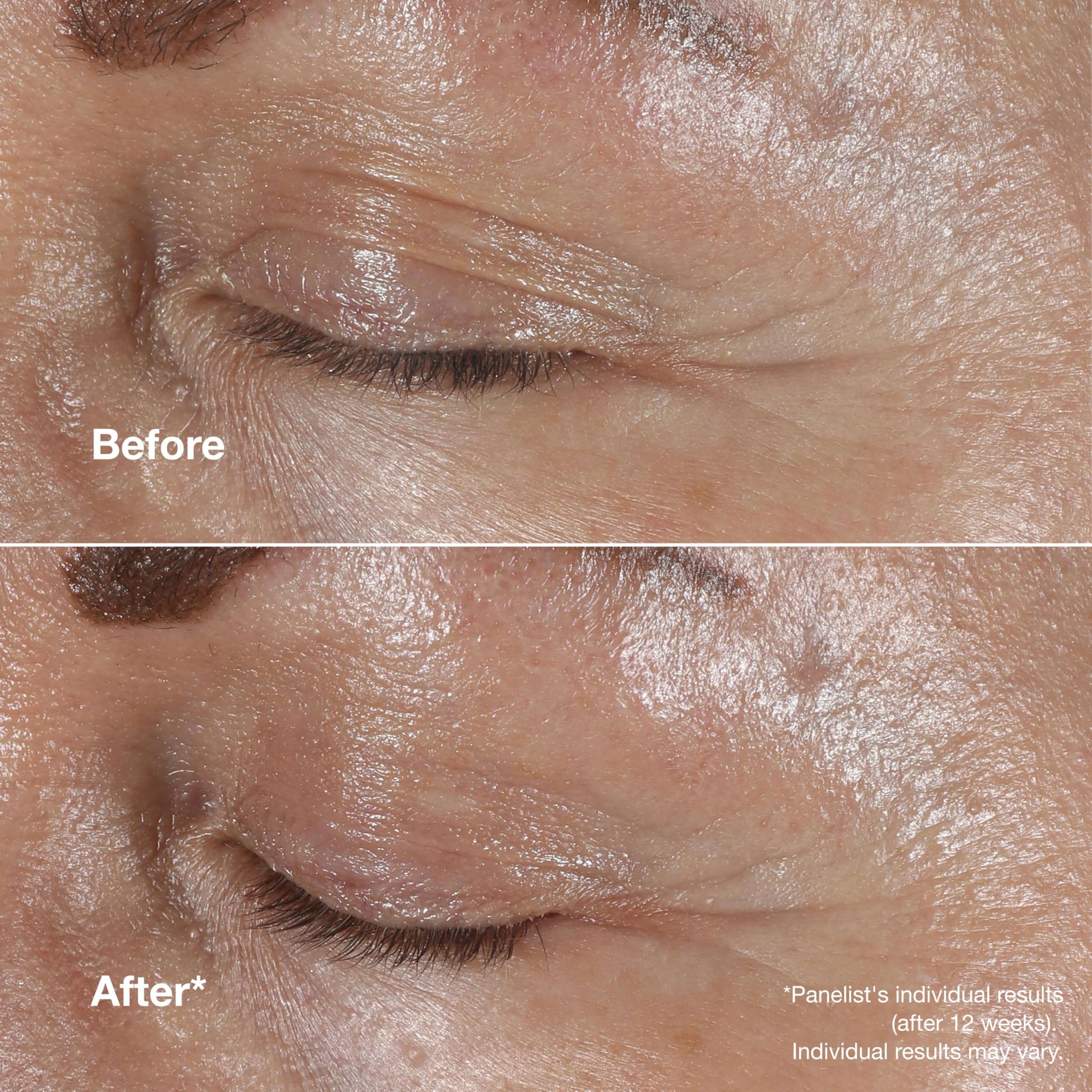 Clinique Smart Clinical Repair Wrinkle Correcting Eye Cream with Hyaluronic 4