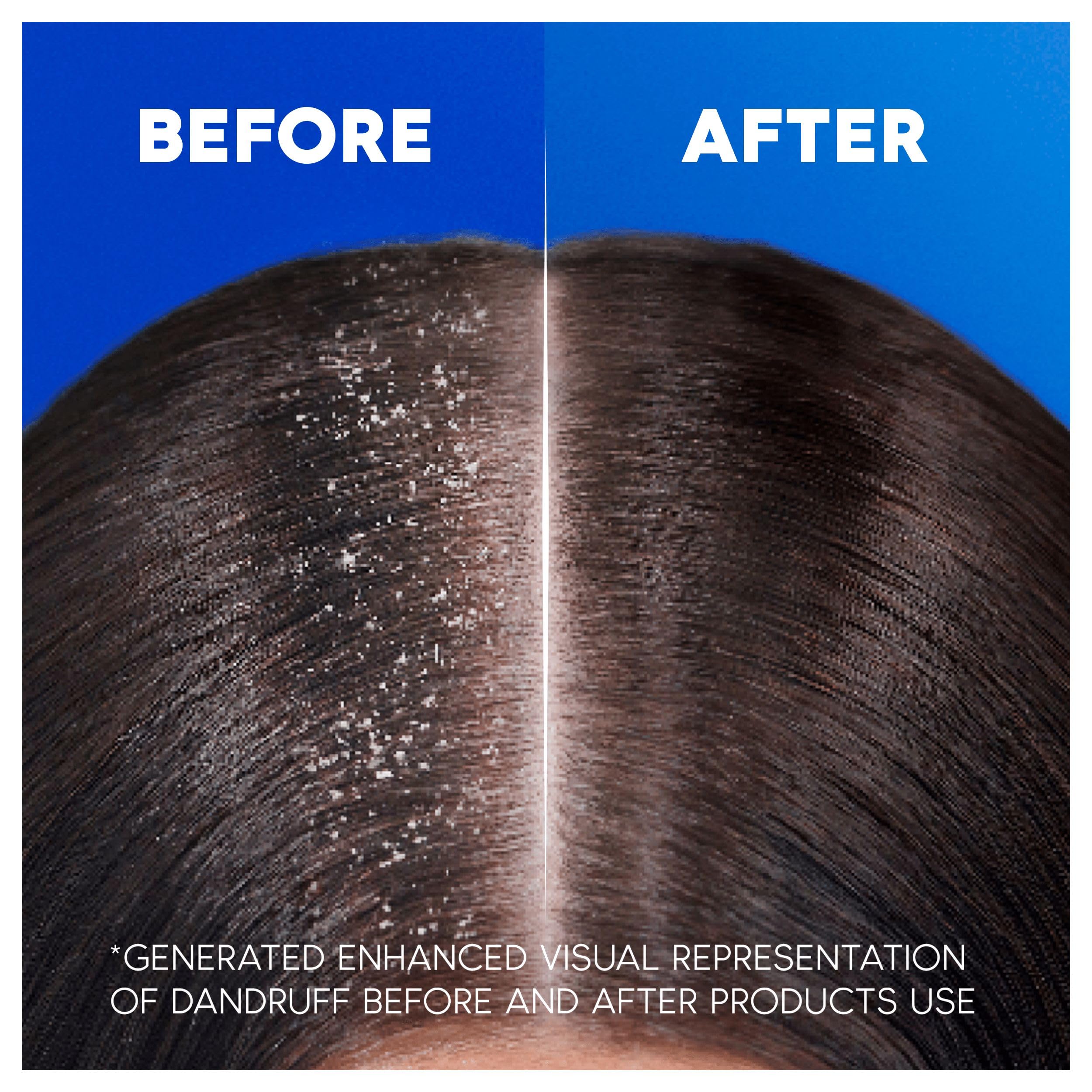 Head & Shoulders Apple Fresh Anti-Dandruff Shampoo for Daily Use, 250ml (6 Pack) 4